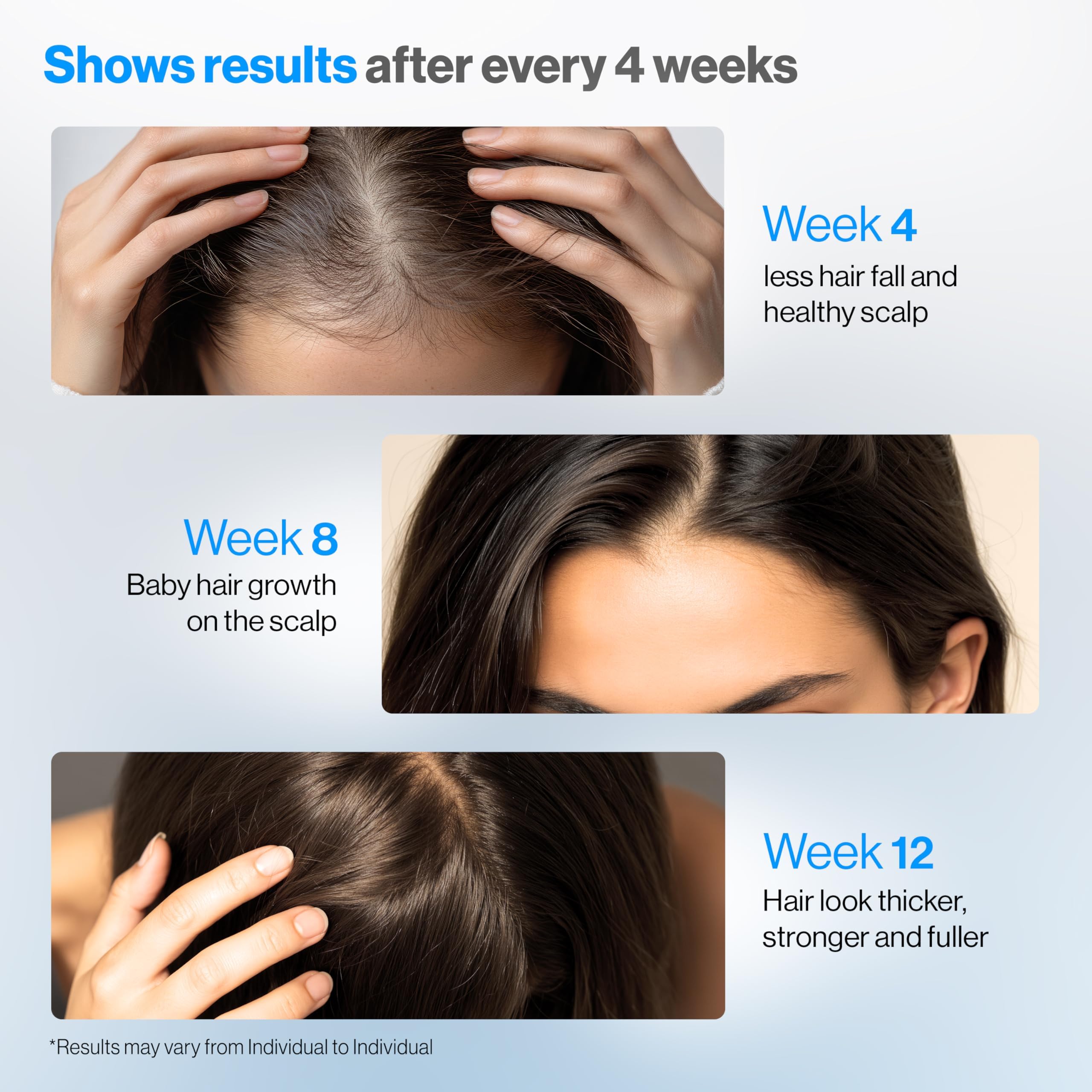 Be Bodywise Rosemary Hair Growth Serum Roll On 50 ml – 3% Rosemary, 3% Redensyl & 2% Anagain | DHT-Blocking Scalp Serum Boosts Oxygen Flow, Reduces Hair Fall | Paraben/Sulfate-Free | Women & Men